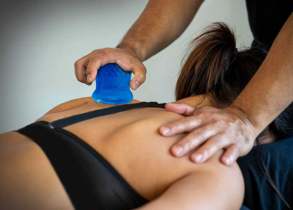 XTRM XNRGY™ Cupping Therapy Set