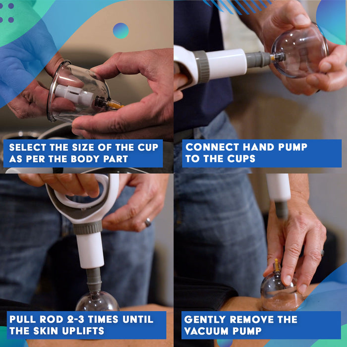 Myofascial Releaser Professional Cupping Therapy Set - 18 Multi-Sized Vacuum Cups with Two Hand Pumps