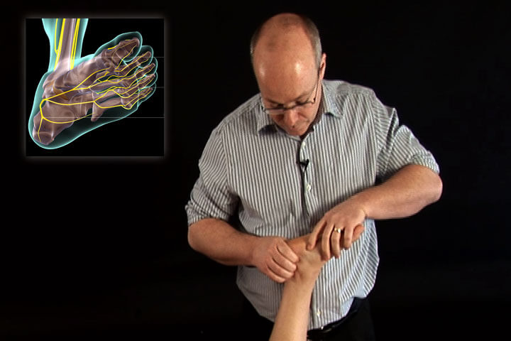 Nerve Mobilization The Lower Body Video on DVD or Streaming Version - Real Bodywork