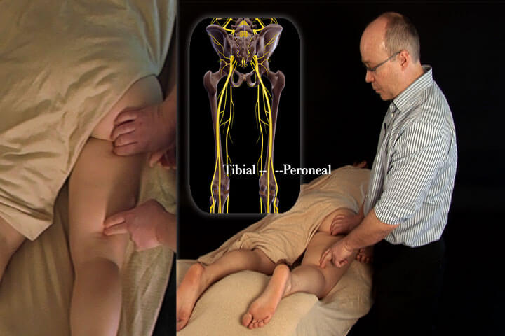 Nerve Mobilization The Lower Body Video on DVD or Streaming Version - Real Bodywork
